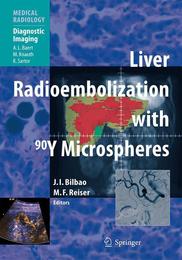 Liver Radioembolization with Y90 Microspheres - Cover