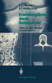 Ermüdungsbruch durch Osteoporose
