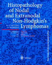 Histopathology of Nodal and Extranodal Non-Hodgkins Lymphomas