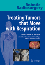 Treating Tumors that Move with Respiration