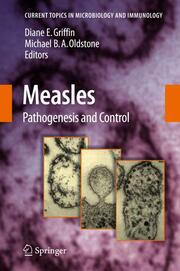 Measles Virus 2