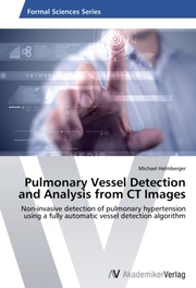 Pulmonary Vessel Detection and Analysis from CT Images