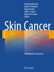 Skin Cancer - A World-Wide Perspective