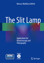The Slit Lamp