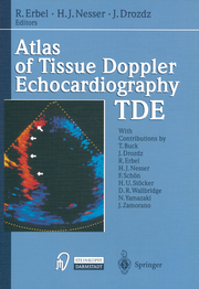 Atlas of Tissue Doppler Echocardiography TDE