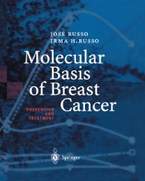 Molecular Basis of Breast Cancer - Abbildung 1
