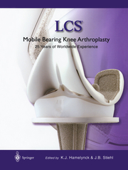 LCS Mobile Bearing Knee Arthroplasty