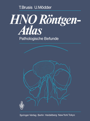 HNO Röntgen-Atlas - Pathologische Befunde