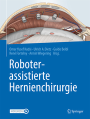 Roboterassistierte Hernienchirurgie