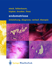 Endometriose