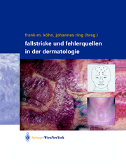 Fallstricke und Fehlerquellen in der Dermatologie - Cover