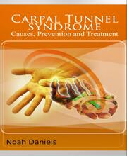 Carpal Tunnel Syndrome - Causes, Prevention and Treatment