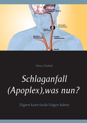 Schlaganfall (Apoplex), was nun?