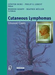 Cutaneous Lymphomas: Unusual Cases