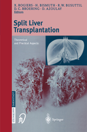 Split-Liver Transplantation