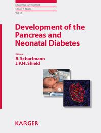 Development of the Pancreas and Neonatal Diabetes