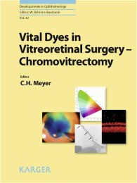 Vital Dyes in Vitreoretinal Surgery