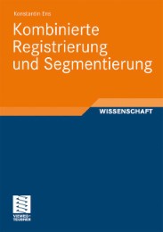 Kombinierte Registrierung und Segmentierung - Abbildung 1