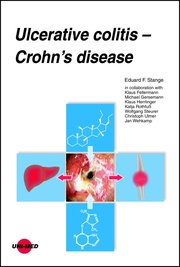 Ulcerative colitis - Crohn's disease - Cover