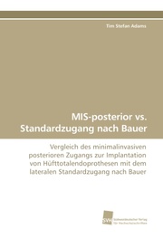 MIS-posterior vs.Standardzugang nach Bauer