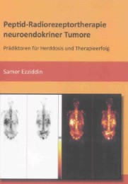 Peptid-Radiorezeptortherapie neuroendokriner Tumore