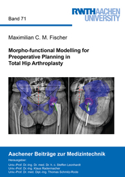 Morpho-functional Modelling for Preoperative Planning in Total Hip Arthroplasty
