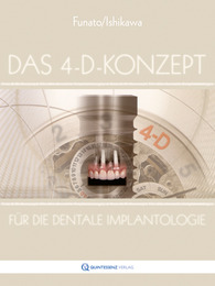 Das 4-D-Konzept für die dentale Implantologie