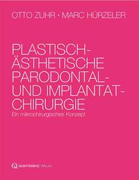Plastisch-ästhetische Parodontal- und Implantatchirurgie - Cover