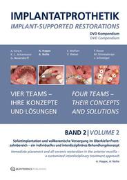 Implantatprothetik. DVD, Band 2 - Cover