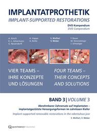 Implantatprothetik. DVD, Band 3