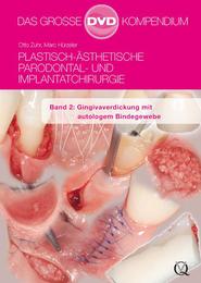 Plastisch-Ästhetische Parodontal- und Implantatchirurgie / Plastisch-Ästhetische Parodontal- und Implantatchirurgie - Cover