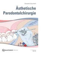 Ästhetische Parodontalchirurgie