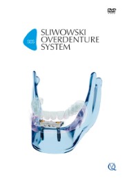 SOS - Sliwowski Overdenture System - Cover