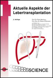 Aktuelle Aspekte der Lebertransplantation