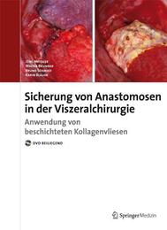 Sicherung von Anastomosen in der Viszeralchirurgie