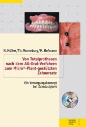 Von Totalprothesen nach dem All-Oral-Verfahren zum Micro©-Plant-gestützten Zahne