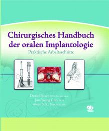 Chirurgisches Handbuch der oralen Implantologie