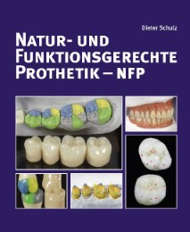 Natur- und funktionsgerechte Prothetik - NFP