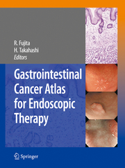 Gastrointestinal Cancer Atlas for Endoscopic Therapy - Cover