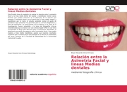 Relación entre la Asimetría Facial y lineas Medias dentales