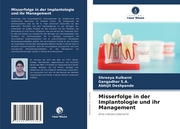 Misserfolge in der Implantologie und ihr Management - Cover