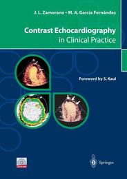 Contrast Echocardiography in Clinical Practice