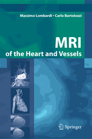 Magnetic Resonance Imaging of the Heart and Vessels