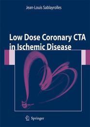Low Dose Coronary CTA in Ischemic Disease
