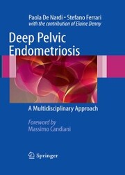Deep Pelvic Endometriosis
