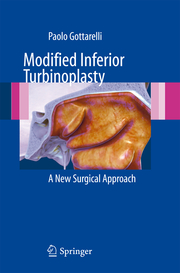 Modified Inferior Turbinoplasty - Cover