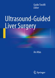Ultrasound-Guided Liver Surgery - Cover
