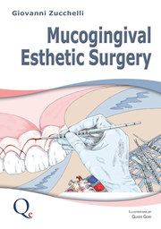 Mucogingival Esthetic Surgery - Cover