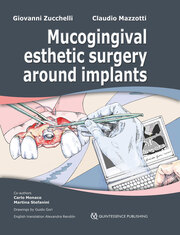 Mucogingival Esthetic Surgery around Implants - Cover