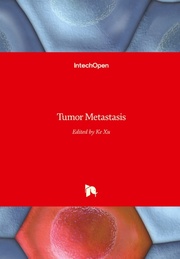 Tumor Metastasis - Cover